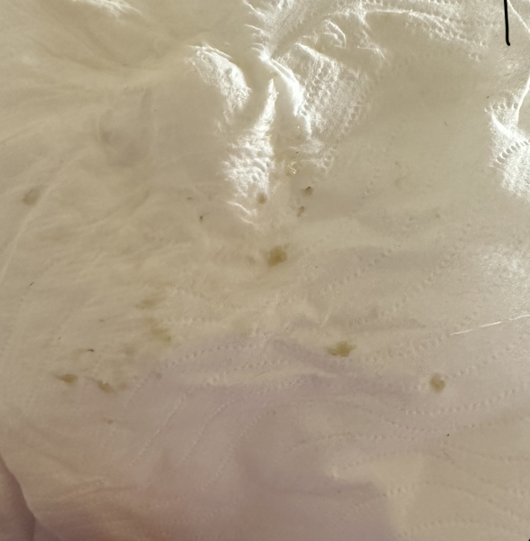 Is it just postpartum vaginal issues or smell/irritation 