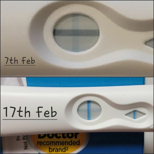Early pregnancy worries, previous miscarriage