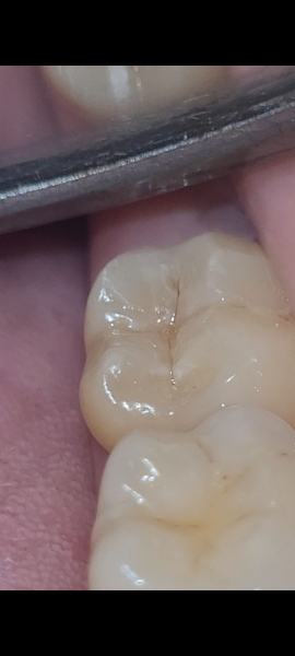 Any dentists on here....(pics)