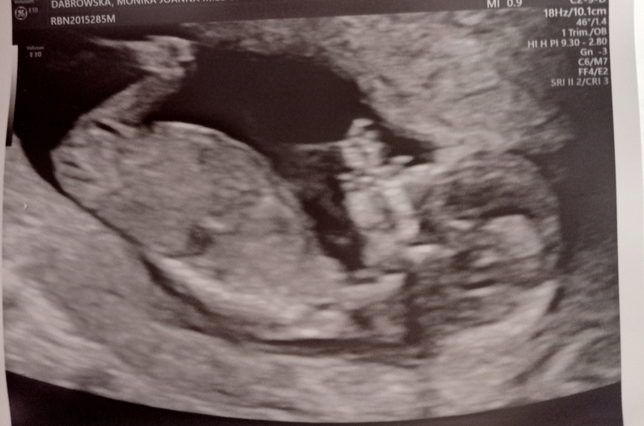 End Aug/Early Sept Due Date (Thread 2)