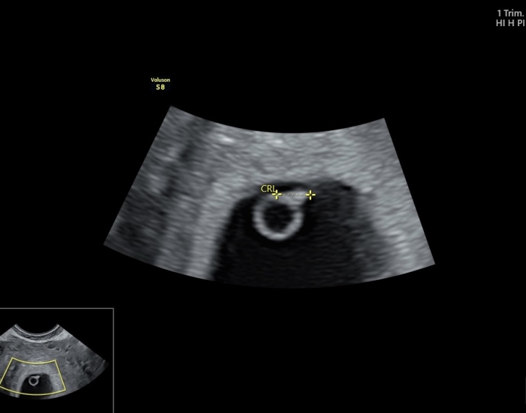 Due October 2023 -Thread 2