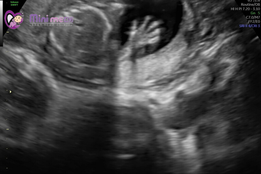 ABC IVF timeline & advice