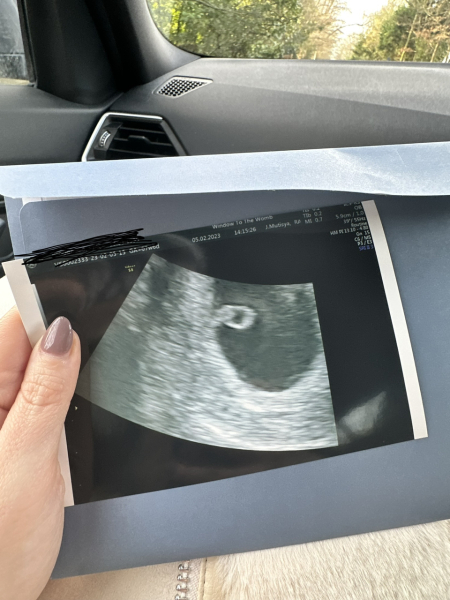 5 weeks today! Sep 23 Thread