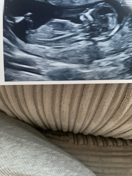 Boy or girl in scan 