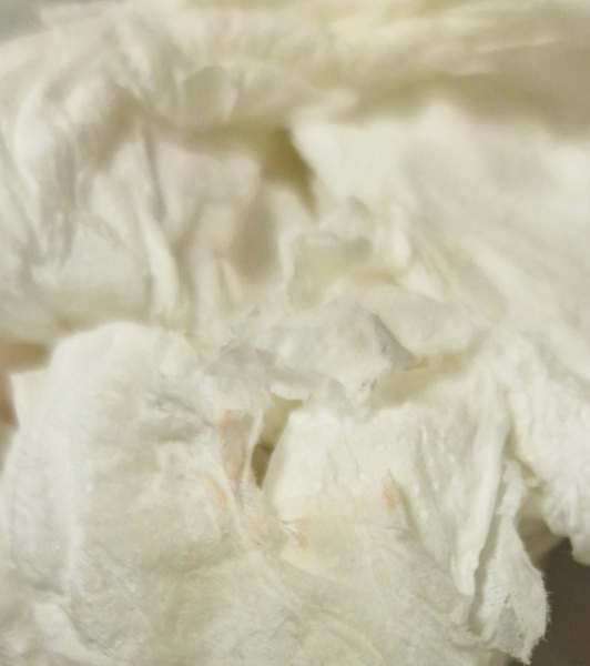 Implantation bleeding? *picture warning*