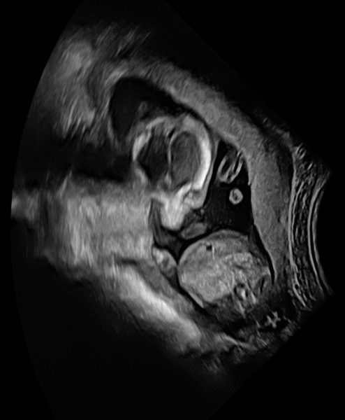 Ultrasound: Is This A Boy Or Girl?