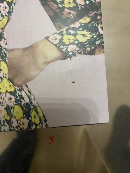 Photo of lice, what age/stage would you say these are ? 