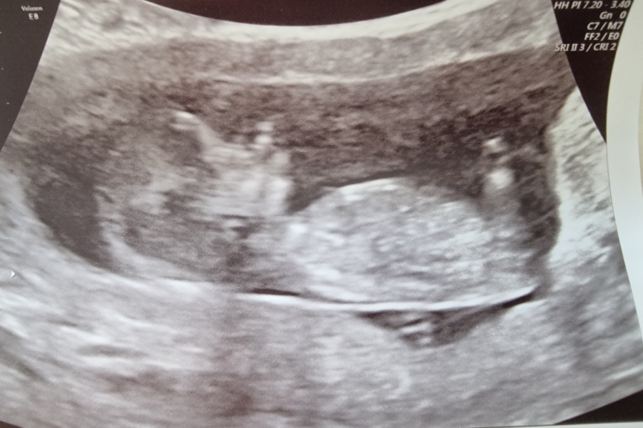 August Due Date Crew - Into Trimester 2 (Thread 6)