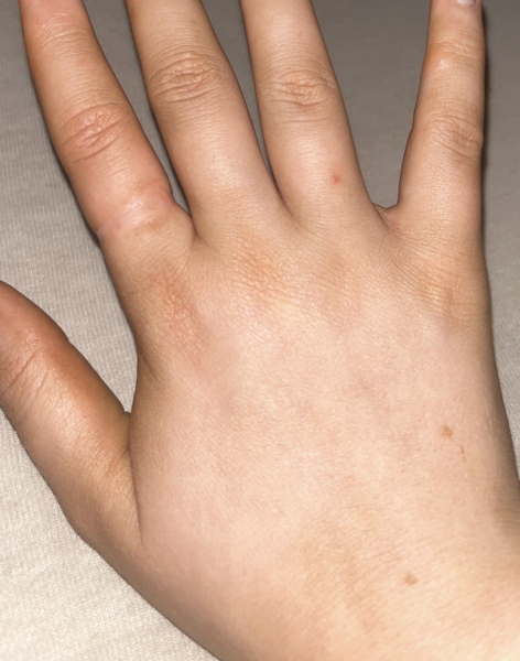 Due March 2023 - Thread 8