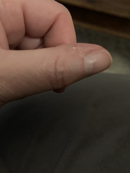 Excuse the photo-nails