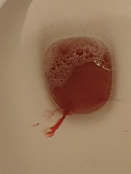 Is this implantation bleeding?