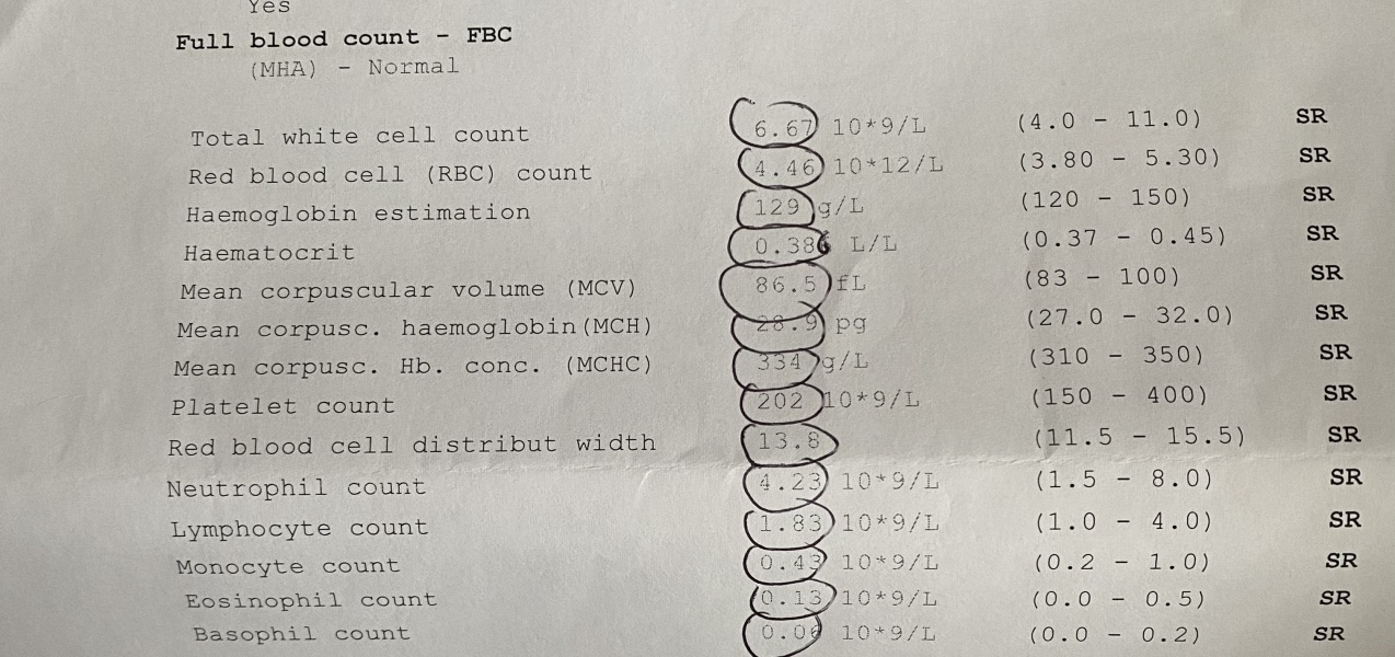 Think I’ve got chronic fatigue syndrome - any advice?