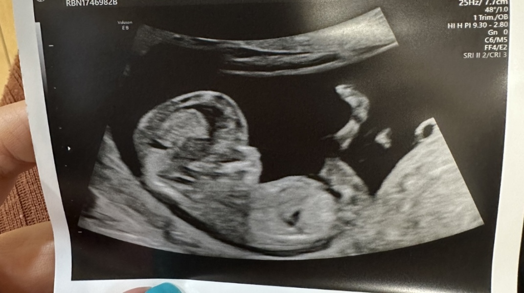 Just for fun! Boy or girl? 