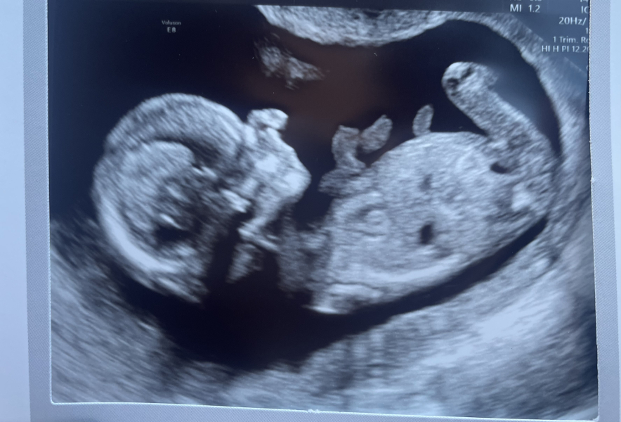 August Due Date Crew - Into Trimester 2 (Thread 6)