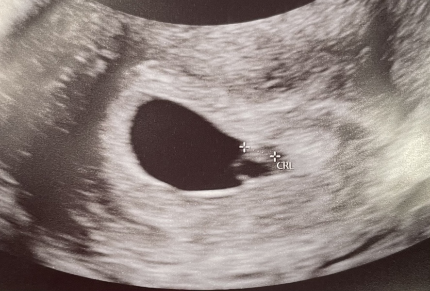 Due October 2023 -Thread 2