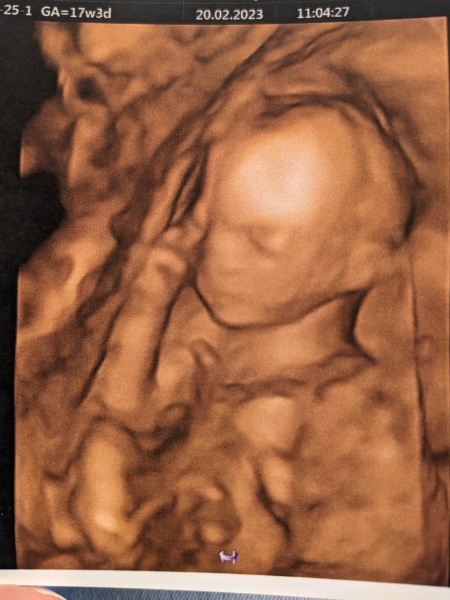 Due July 2023 thread 2