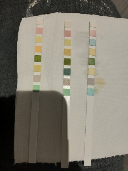Any midwives/HCP around? (Pic) Protein ++++ on old, dry urine dipstick