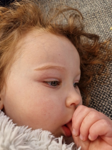 Toddler symptoms.. does this sound like meningitis?
