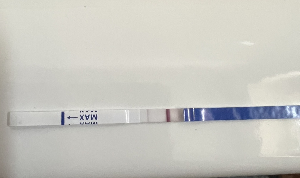 7.4 weeks no heartbeat 