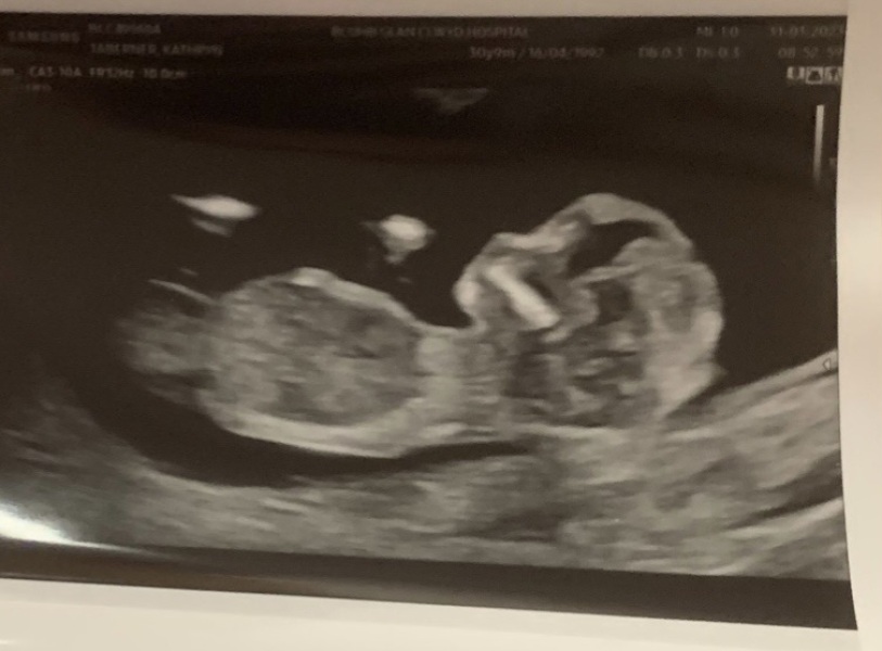 Boy or girl