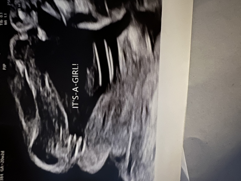 Baby gender 20 weeks