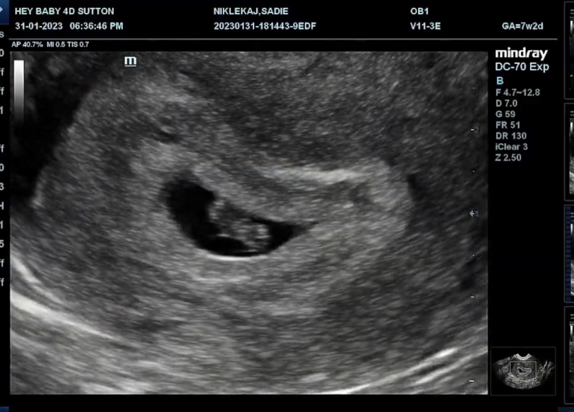 5 weeks today! Sep 23 Thread