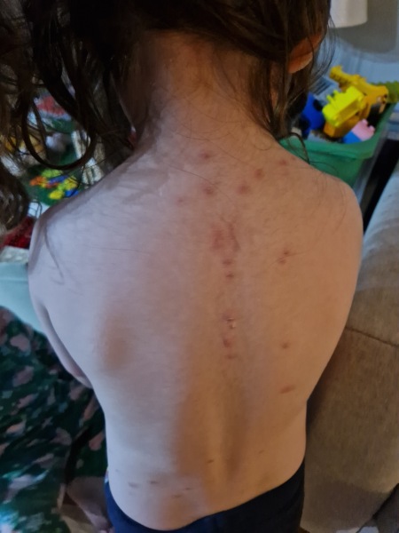 Fleas or bed bugs? Please help! Pic attached.