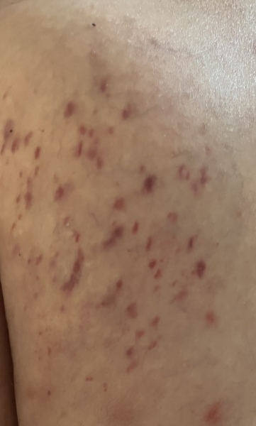 What the Christ is this medical condition. Any drs/anyone she’d any light