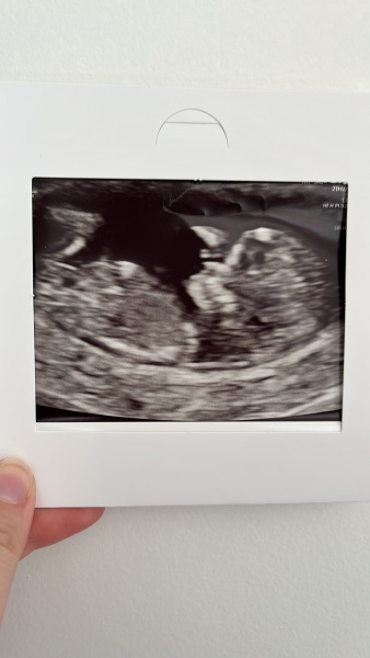 Anyone want to predict baby’s sex?! 