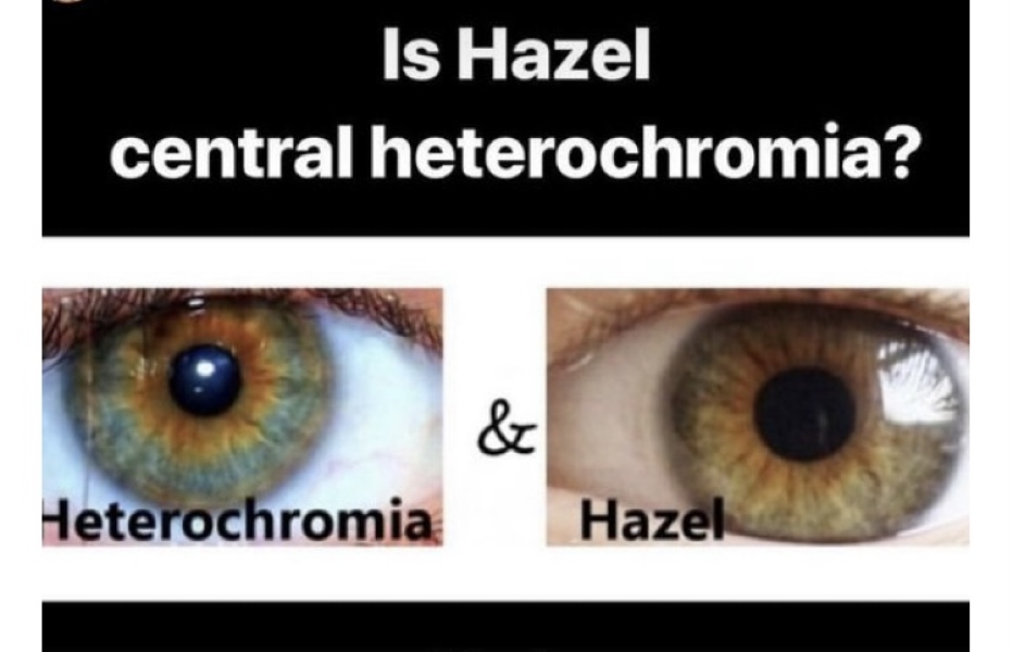 Eye Colour disagreement 