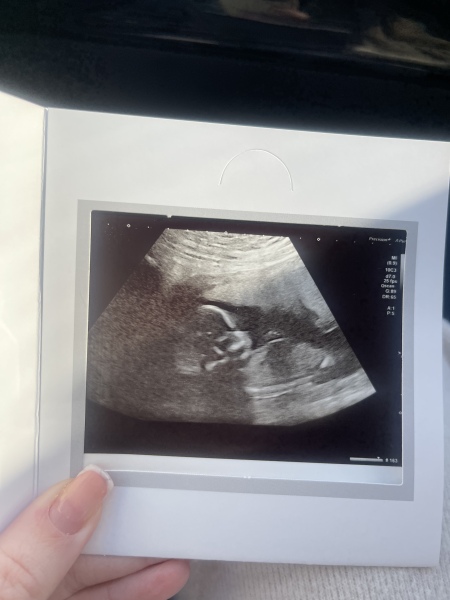 August Due Date Crew - Into Trimester 2 (Thread 6)