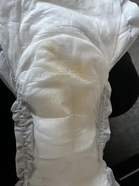 Waters breaking at 31 weeks TRIGGER WARNING PICTURE IN CHAT 