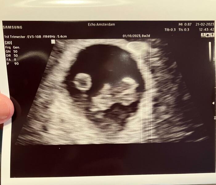 Due September 2023 after miscarriage 🌈