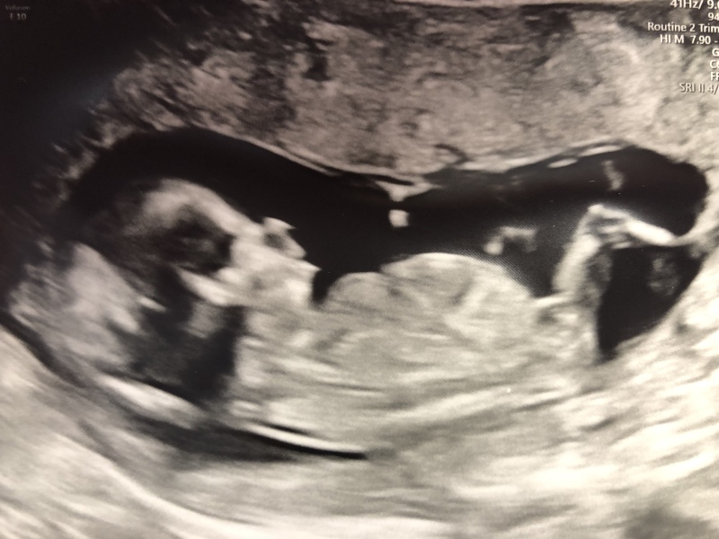 August Due Date Crew - Into Trimester 2 (Thread 6)