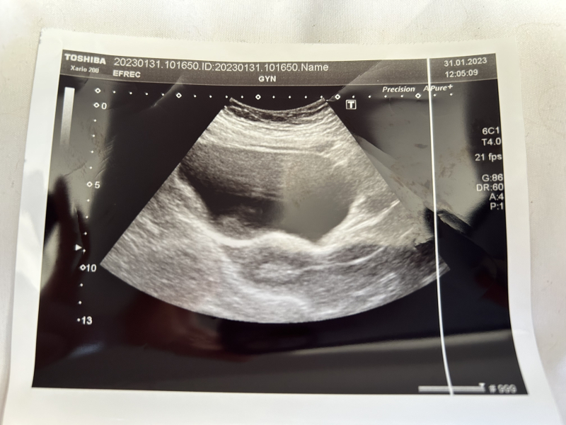 Starting IVF December 2022- looking for a tribe!