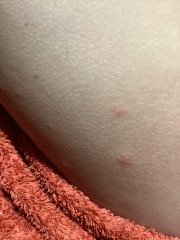 Please have a look at this rash