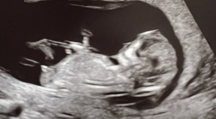 End Aug/Early Sept Due Date (Thread 2)
