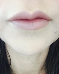 To get lip filler at aged 50