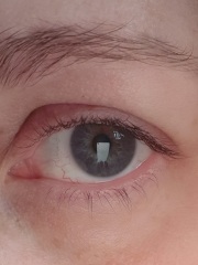 I'm 40 and I don't know what colour my eyes are! Photos