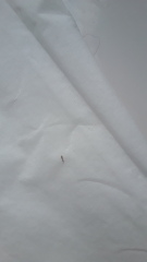 Scratched this thing out of my shoulder 