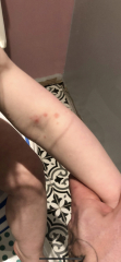 What's this rash?