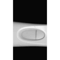 TWW 1dpo today - who's with me?