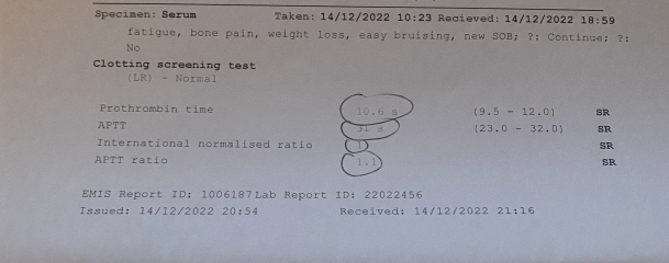 Think I’ve got chronic fatigue syndrome - any advice?