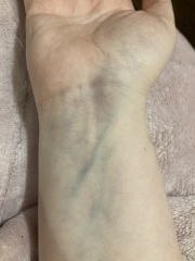 Something weird happened to my wrist today