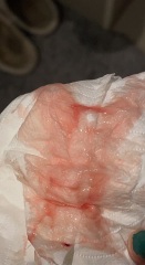 BLOODY SHOW? Picture TW