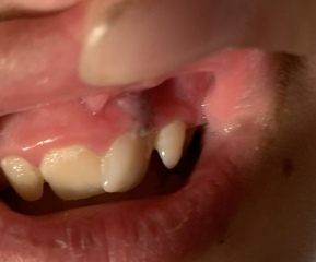 Any dentists or medics on? 