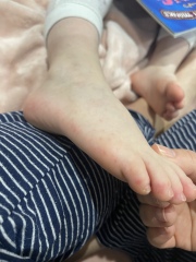 Anyone know what this rash is?