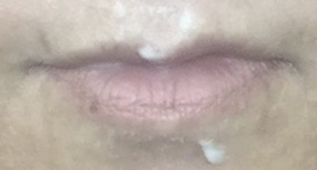 To get lip filler at aged 50