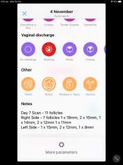 What IVF dose and how many eggs did you get?