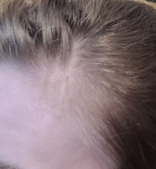 Thinning temples?